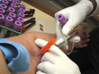 Liquid Biopsy – what to expect?